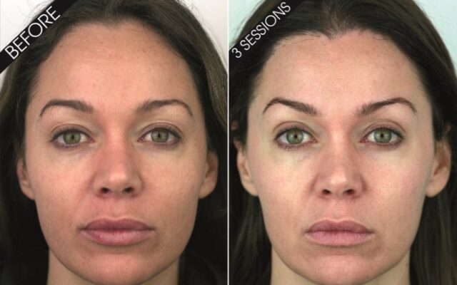 Customer Results