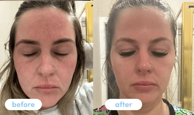 Customer Results